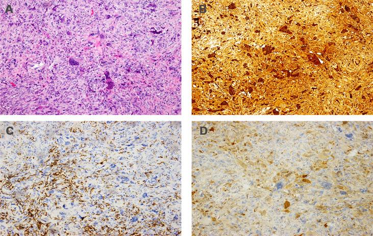 https://cdn.ncbi.nlm.nih.gov/pmc/blobs/73a7/8602786/23499674c281/fonc-11-638237-g005.jpg