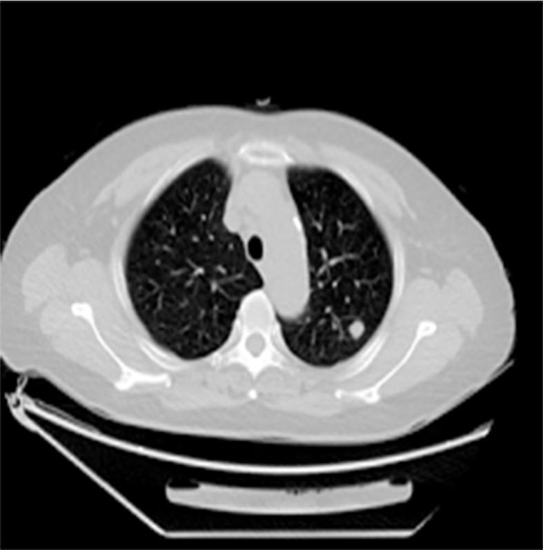 https://cdn.ncbi.nlm.nih.gov/pmc/blobs/73a7/8602786/e8f63ccd7a39/fonc-11-638237-g004.jpg