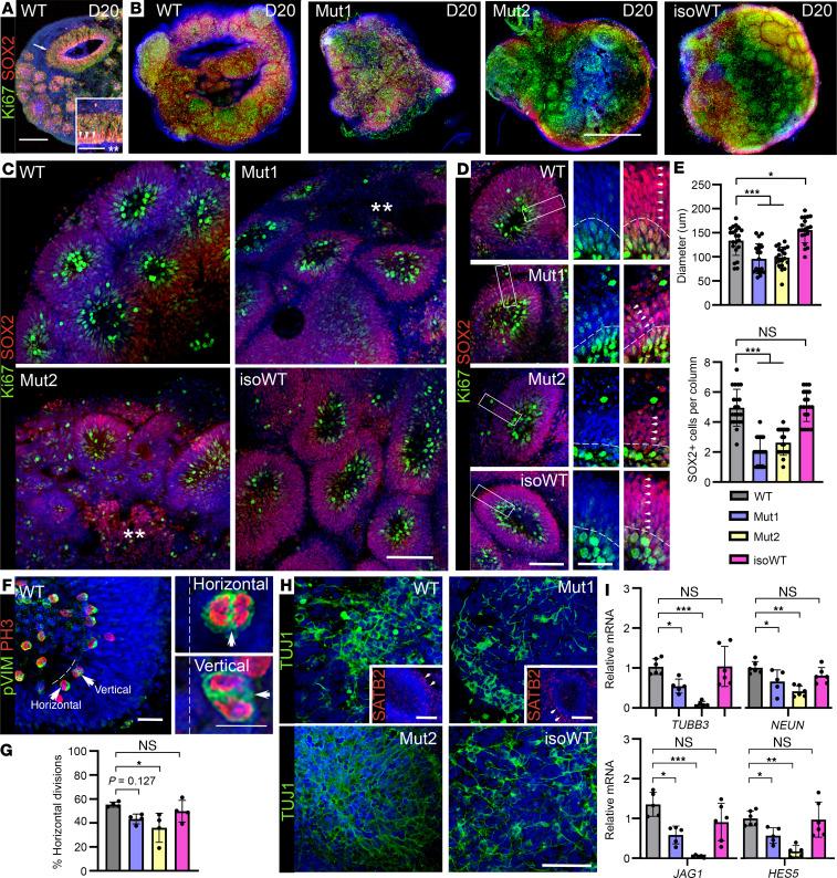 https://cdn.ncbi.nlm.nih.gov/pmc/blobs/73a8/11128209/69e3af44a4fe/jciinsight-9-174645-g176.jpg