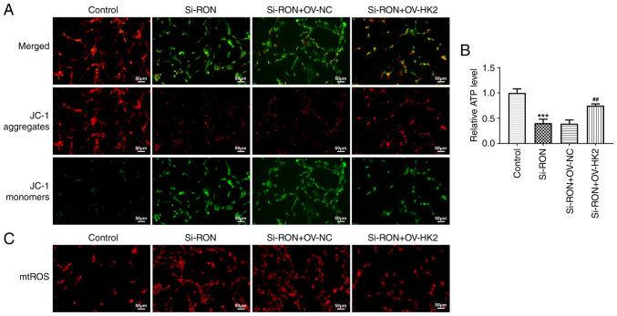 https://cdn.ncbi.nlm.nih.gov/pmc/blobs/73b5/11529188/ada63887d644/mmr-30-06-13359-g07.jpg