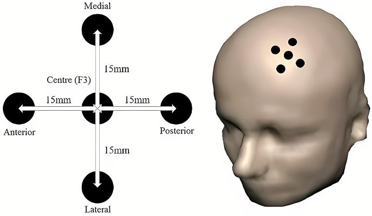 https://cdn.ncbi.nlm.nih.gov/pmc/blobs/73b7/11591941/15df0fb0d61c/brainsci-14-01092-g005.jpg