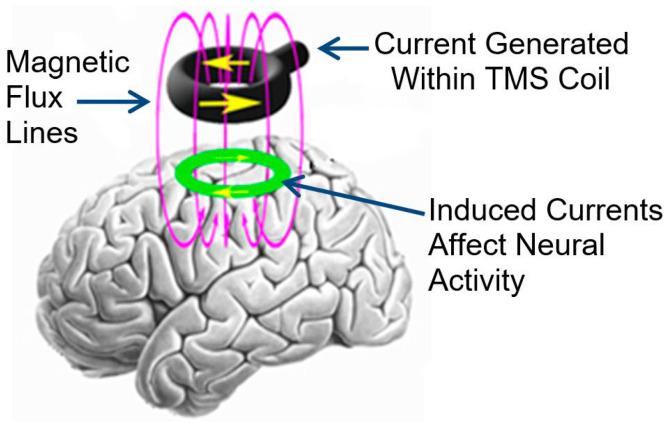 https://cdn.ncbi.nlm.nih.gov/pmc/blobs/73b7/11591941/34772b3899d6/brainsci-14-01092-g001.jpg