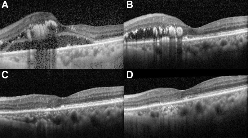 https://cdn.ncbi.nlm.nih.gov/pmc/blobs/73bc/11441943/0454c722ccf4/medi-103-e39768-g003.jpg