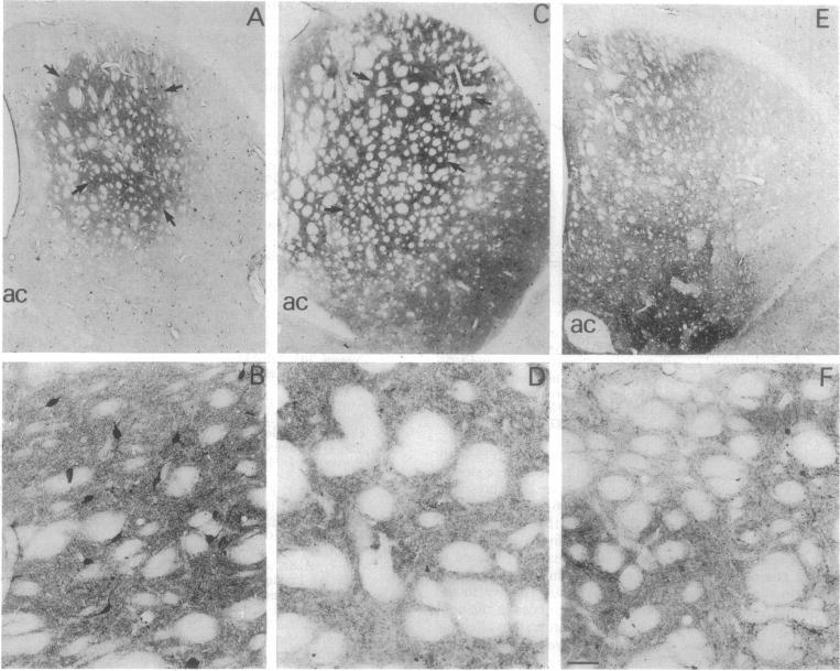 https://cdn.ncbi.nlm.nih.gov/pmc/blobs/73bf/44750/2cd7884b3580/pnas01141-0360-a.jpg