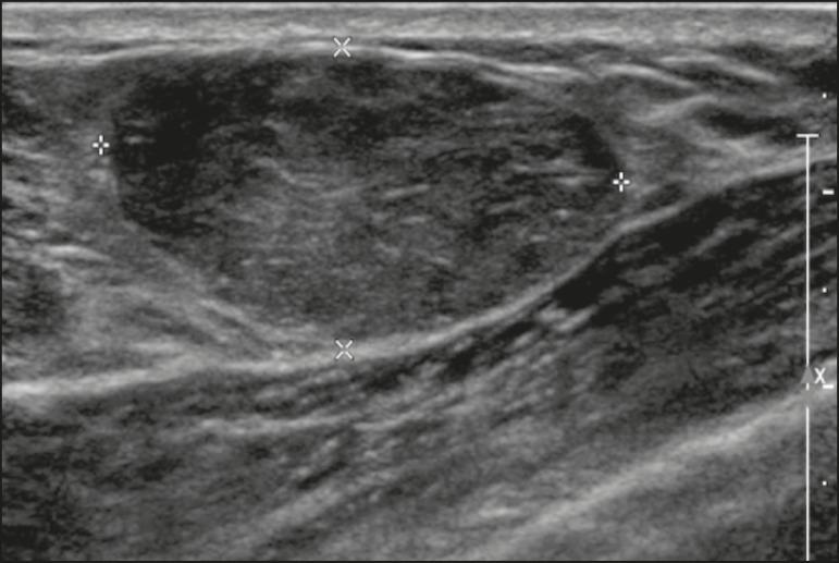 https://cdn.ncbi.nlm.nih.gov/pmc/blobs/73c5/7720671/748c812afafe/rb-53-06-0405-g04.jpg