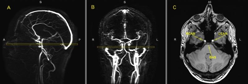 https://cdn.ncbi.nlm.nih.gov/pmc/blobs/73cc/5391232/bff135ddba7e/aging-09-790-g005.jpg