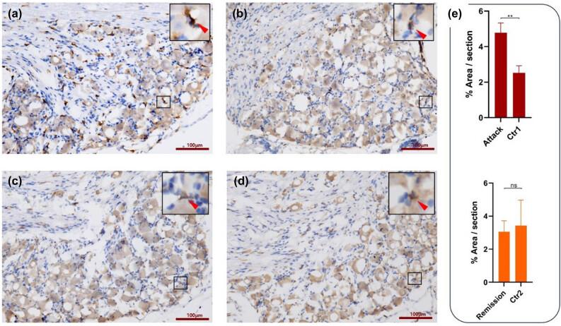 https://cdn.ncbi.nlm.nih.gov/pmc/blobs/73ce/11500528/7bb3b4863c9a/j_tnsci-2022-0355-fig002.jpg