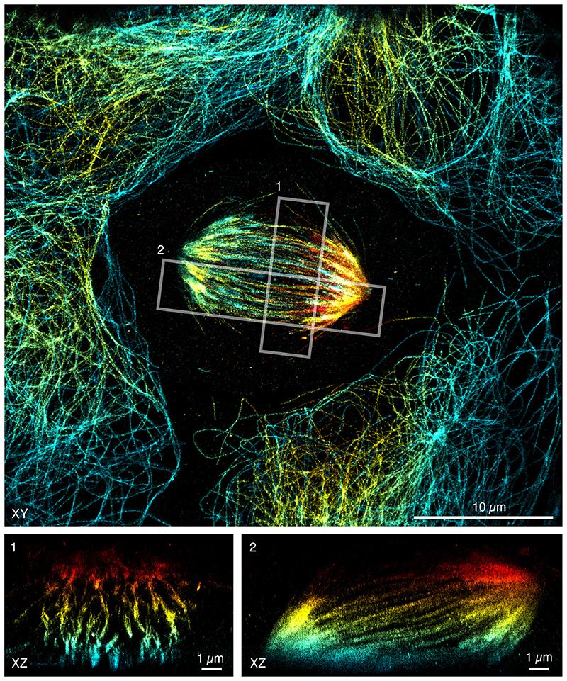 https://cdn.ncbi.nlm.nih.gov/pmc/blobs/73d1/7610360/10c9bf2f8544/EMS118375-f007.jpg