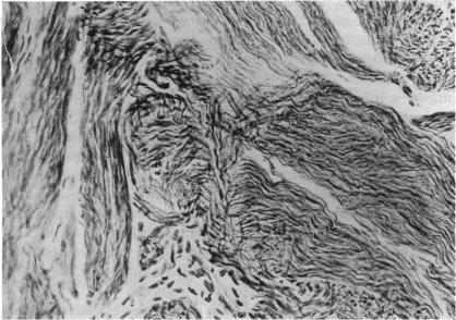 https://cdn.ncbi.nlm.nih.gov/pmc/blobs/73d3/1312592/4a55cc53c676/taos00047-0208-b.jpg