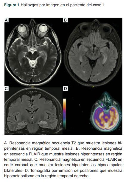 https://cdn.ncbi.nlm.nih.gov/pmc/blobs/73de/10727757/d3e20809a99f/04435117-61-6-868-f001.jpg