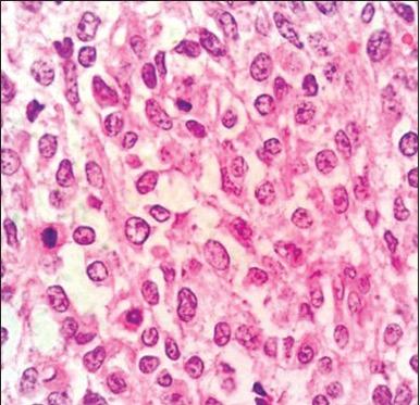 https://cdn.ncbi.nlm.nih.gov/pmc/blobs/73df/4248522/39122568d674/IJD-59-631a-g006.jpg