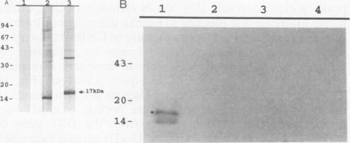 https://cdn.ncbi.nlm.nih.gov/pmc/blobs/73ee/281349/1dabbc5953de/iai00016-0048-c.jpg