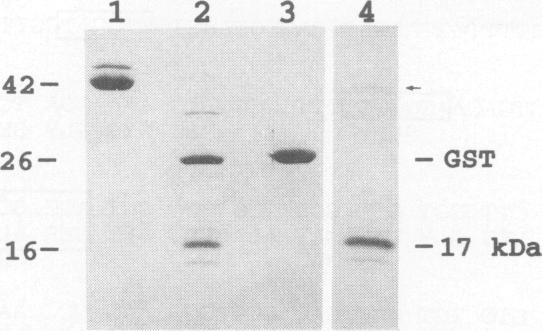 https://cdn.ncbi.nlm.nih.gov/pmc/blobs/73ee/281349/6387109537dd/iai00016-0048-a.jpg