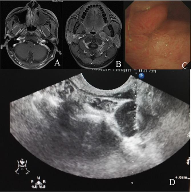 https://cdn.ncbi.nlm.nih.gov/pmc/blobs/73f5/5522073/080320d1a287/oncotarget-08-42372-g005.jpg