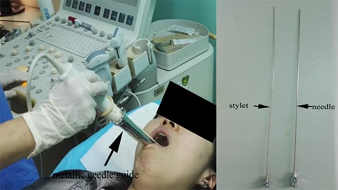 https://cdn.ncbi.nlm.nih.gov/pmc/blobs/73f5/5522073/bc2e5512963f/oncotarget-08-42372-g004.jpg