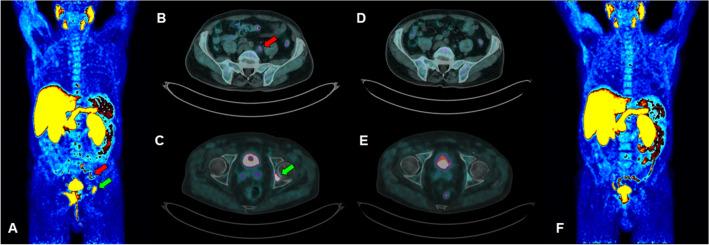 https://cdn.ncbi.nlm.nih.gov/pmc/blobs/73fd/9333077/310f8e9b6ea0/40336_2022_515_Fig1_HTML.jpg