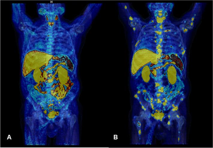 https://cdn.ncbi.nlm.nih.gov/pmc/blobs/73fd/9333077/3b9d2ceab8db/40336_2022_515_Fig4_HTML.jpg