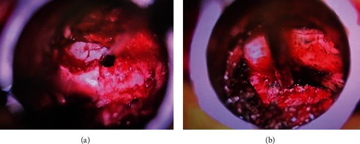 https://cdn.ncbi.nlm.nih.gov/pmc/blobs/73fe/7648676/0acd09002ed3/MIS2020-5346805.002.jpg