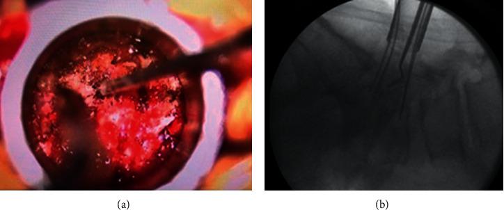 https://cdn.ncbi.nlm.nih.gov/pmc/blobs/73fe/7648676/cf56f01fa705/MIS2020-5346805.001.jpg