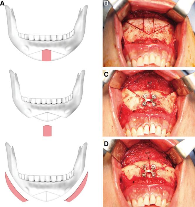 https://cdn.ncbi.nlm.nih.gov/pmc/blobs/7402/4236372/c0ce55850242/gox-2-e227-g004.jpg