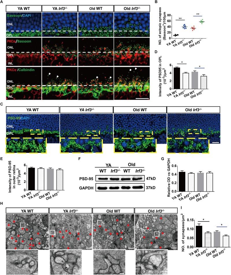 https://cdn.ncbi.nlm.nih.gov/pmc/blobs/7405/6596281/b309739d387f/fncel-13-00272-g004.jpg