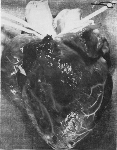 https://cdn.ncbi.nlm.nih.gov/pmc/blobs/7408/1613296/4b852f97ff95/annsurg01299-0049-b.jpg