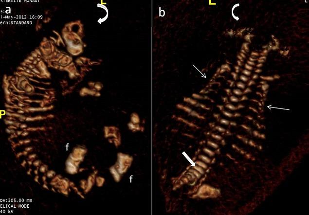 https://cdn.ncbi.nlm.nih.gov/pmc/blobs/740a/5324159/20a8fdafc6ab/PAMJ-25-88-g005.jpg