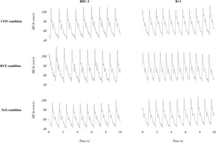 https://cdn.ncbi.nlm.nih.gov/pmc/blobs/740d/6718616/4b996ecc7862/fphys-10-01114-g003.jpg