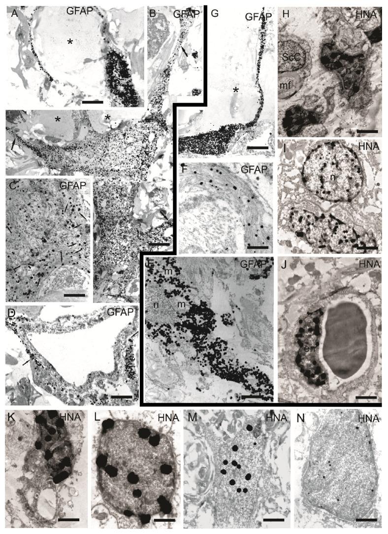 https://cdn.ncbi.nlm.nih.gov/pmc/blobs/740e/5379091/b614844bb974/NP2017-9857918.005.jpg