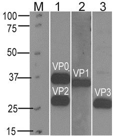 https://cdn.ncbi.nlm.nih.gov/pmc/blobs/740f/4042139/4eb8e4879d2a/1743-422X-11-99-4.jpg