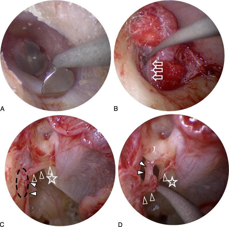 https://cdn.ncbi.nlm.nih.gov/pmc/blobs/7413/12379789/7da76cefc8da/on-46-e316-g001.jpg