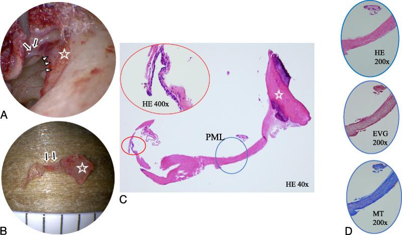https://cdn.ncbi.nlm.nih.gov/pmc/blobs/7413/12379789/fe9a68d6bc2c/on-46-e316-g004.jpg