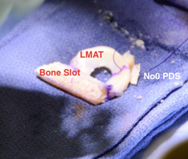 https://cdn.ncbi.nlm.nih.gov/pmc/blobs/7414/5710720/48bdc7692410/gr10.jpg