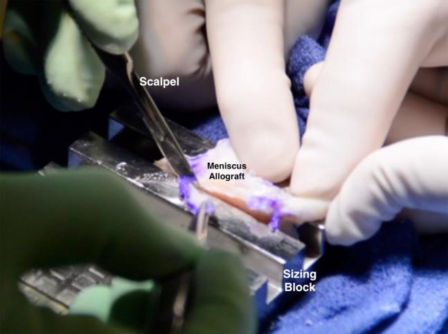 https://cdn.ncbi.nlm.nih.gov/pmc/blobs/7414/5710720/ba5c42930b44/gr9.jpg