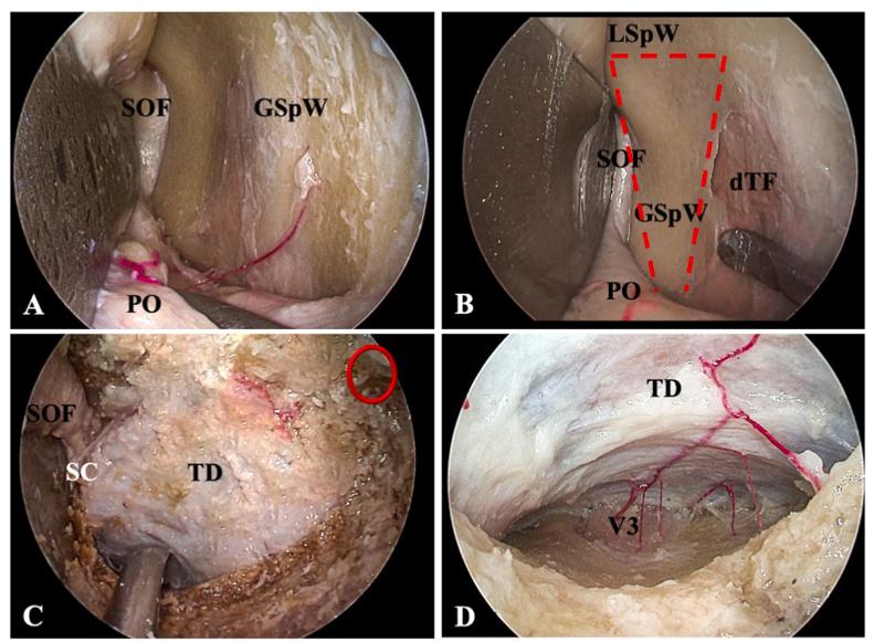 https://cdn.ncbi.nlm.nih.gov/pmc/blobs/741a/10753433/17b514f28ee3/gr3.jpg