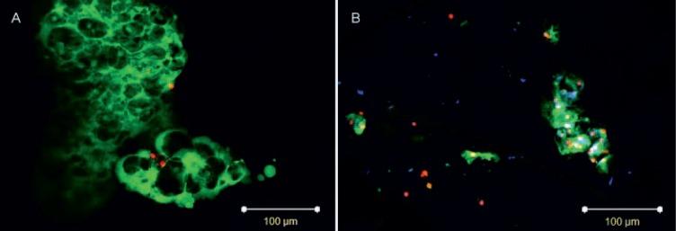 https://cdn.ncbi.nlm.nih.gov/pmc/blobs/7420/5400162/1531a33af6d4/10.1055_s-0036-1583174-fig2.jpg