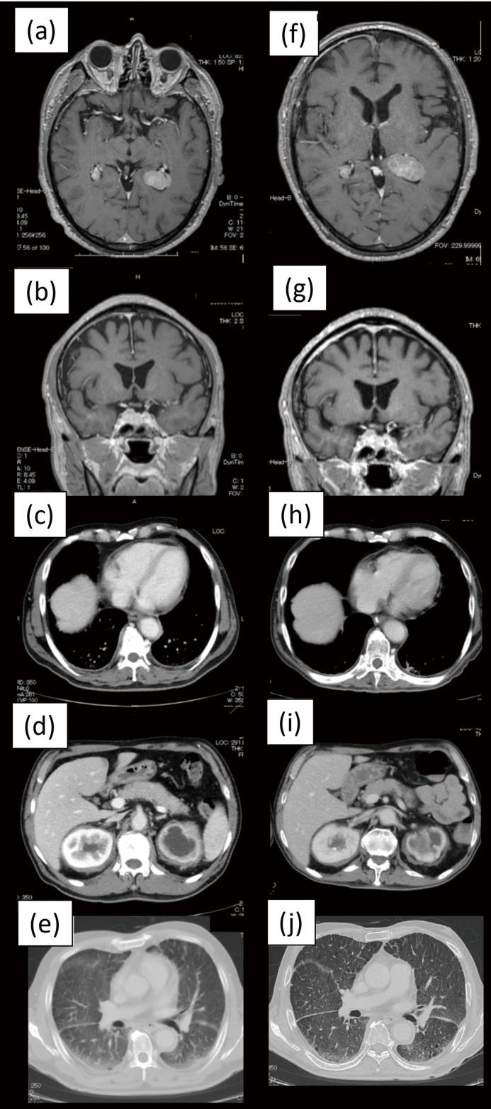 https://cdn.ncbi.nlm.nih.gov/pmc/blobs/7424/6407475/ba3eebc81882/jslrt-58-161-g001.jpg