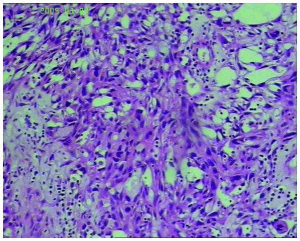 https://cdn.ncbi.nlm.nih.gov/pmc/blobs/742b/4356293/c7babe42e2a9/OL-09-04-1725-g00.jpg