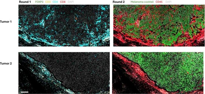 https://cdn.ncbi.nlm.nih.gov/pmc/blobs/743a/12286418/1c94f9e3614d/PCMR-38-0-g003.jpg
