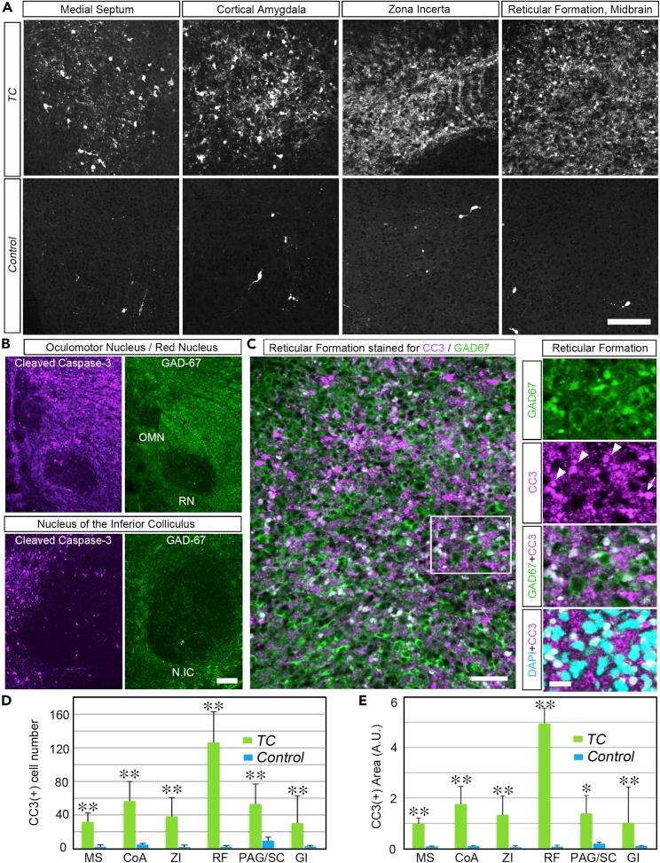 https://cdn.ncbi.nlm.nih.gov/pmc/blobs/743a/9793319/cc2caf4863c4/gr4.jpg