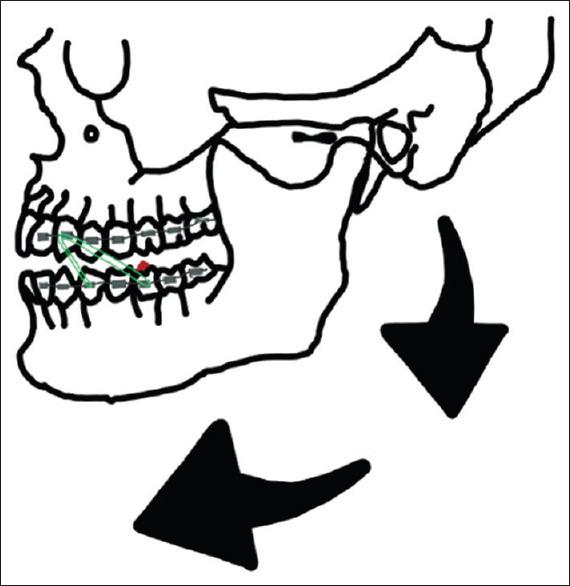 https://cdn.ncbi.nlm.nih.gov/pmc/blobs/7443/9214453/867697060628/JOS-11-30-g004.jpg