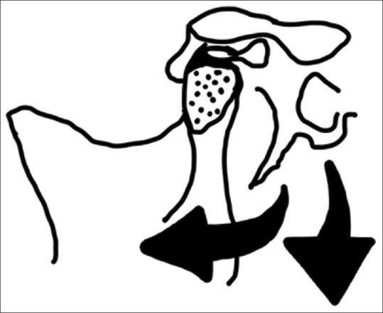 https://cdn.ncbi.nlm.nih.gov/pmc/blobs/7443/9214453/d3580557d3c2/JOS-11-30-g005.jpg