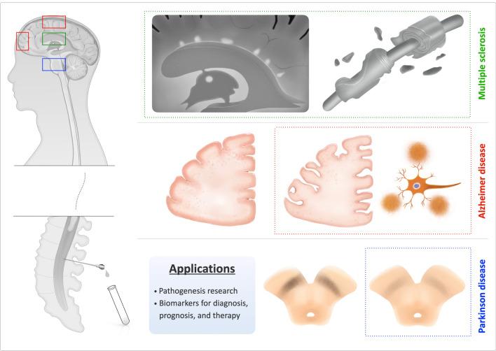 https://cdn.ncbi.nlm.nih.gov/pmc/blobs/7449/7917176/a71b1289ce98/40291_2021_513_Fig3_HTML.jpg