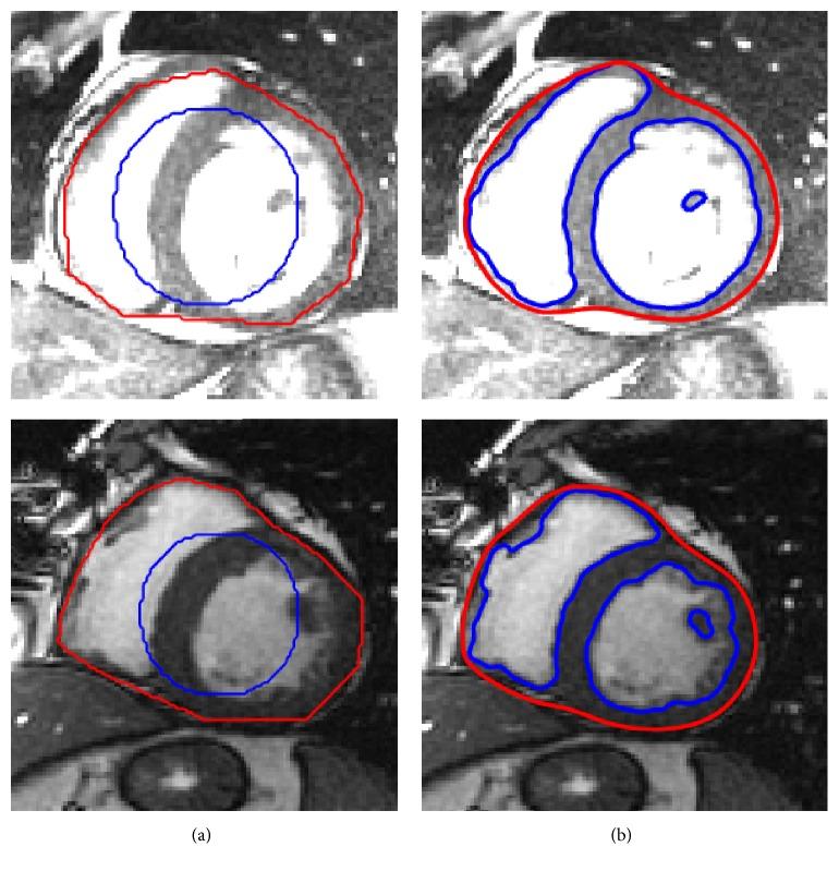 https://cdn.ncbi.nlm.nih.gov/pmc/blobs/744c/5591936/548fc125aa8c/CMMM2017-8350680.009.jpg