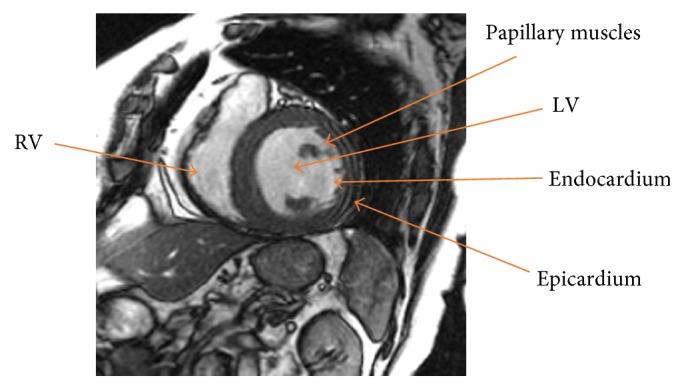 https://cdn.ncbi.nlm.nih.gov/pmc/blobs/744c/5591936/702046ba7759/CMMM2017-8350680.001.jpg
