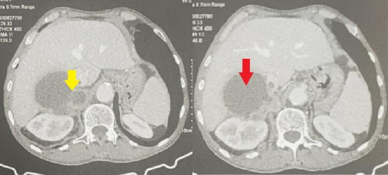 https://cdn.ncbi.nlm.nih.gov/pmc/blobs/744f/12337654/4decfb5f7d1f/gr1.jpg