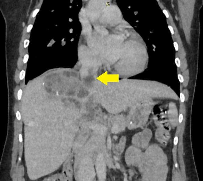 https://cdn.ncbi.nlm.nih.gov/pmc/blobs/744f/12337654/b053fccf3f49/gr4.jpg