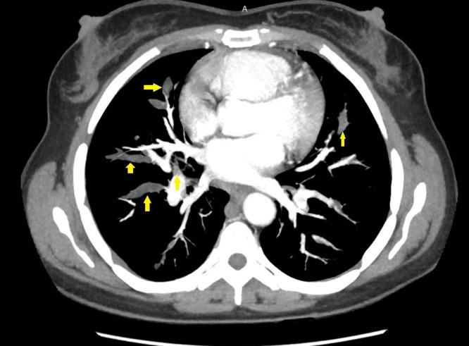 https://cdn.ncbi.nlm.nih.gov/pmc/blobs/744f/12337654/dbfeec5ee367/gr3.jpg