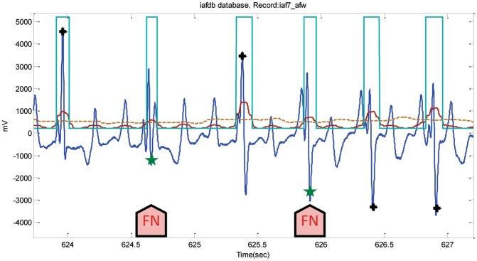 https://cdn.ncbi.nlm.nih.gov/pmc/blobs/7459/3774726/68458a224361/pone.0073557.g013.jpg