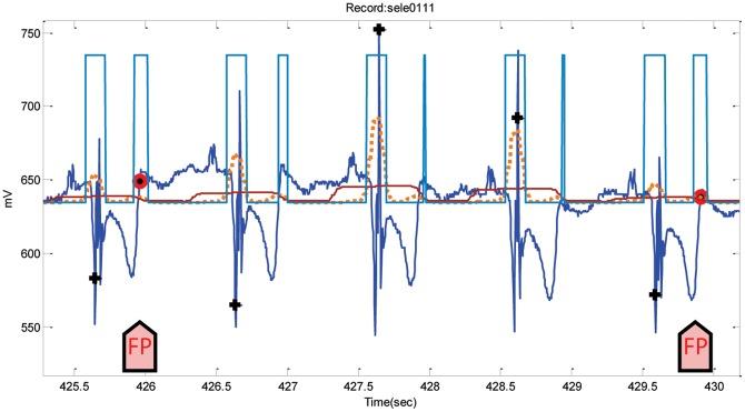 https://cdn.ncbi.nlm.nih.gov/pmc/blobs/7459/3774726/b5f9dadfdf74/pone.0073557.g015.jpg